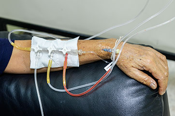 Patient needing chemotherapy-induced peripheral neuropathy treatment in Orange